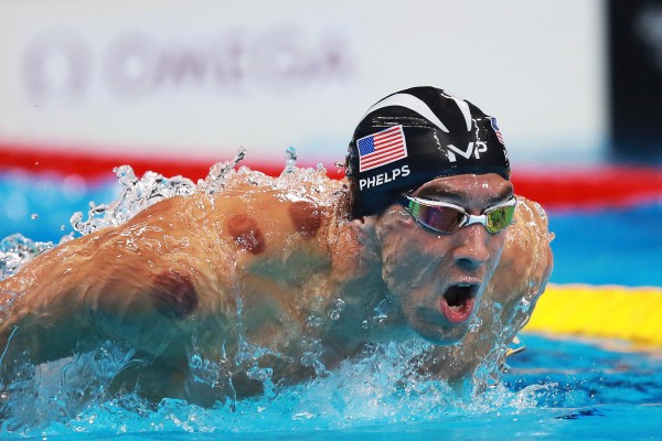 Michael Phelps does fire cupping