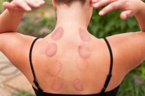 Marks | The Truth About Chinese Frecupping